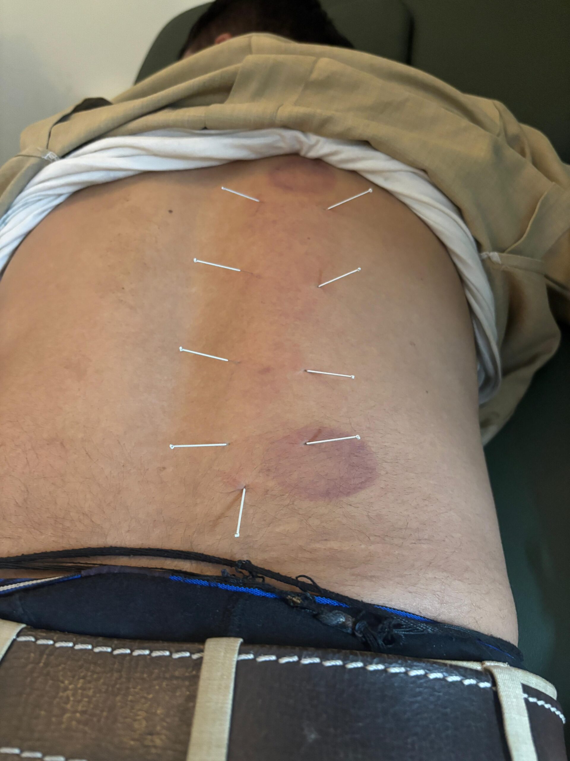 Physiotherapy clinic in Delhi