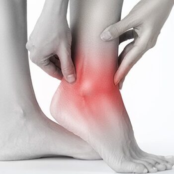 ankle sprain treatment